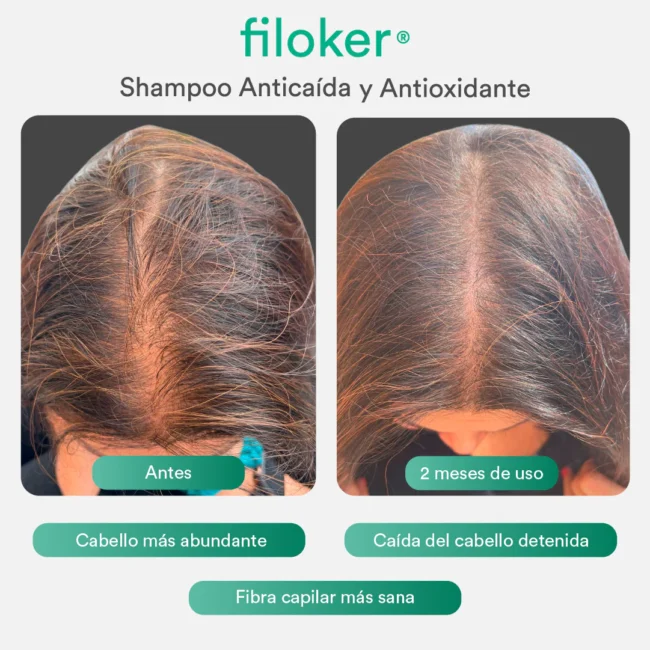 filoker_shampoo_antes-despues-01.webp