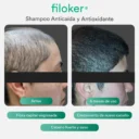 filoker_shampoo_antes-despues-02.webp